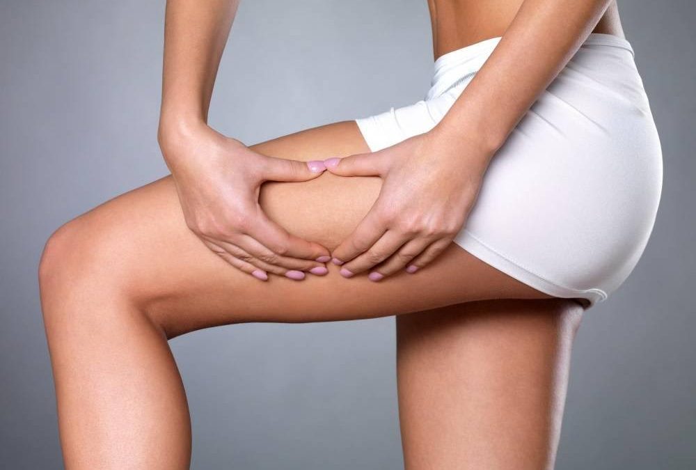 Discover 4 Amazing Home Remedies To Fight Cellulite Naturally